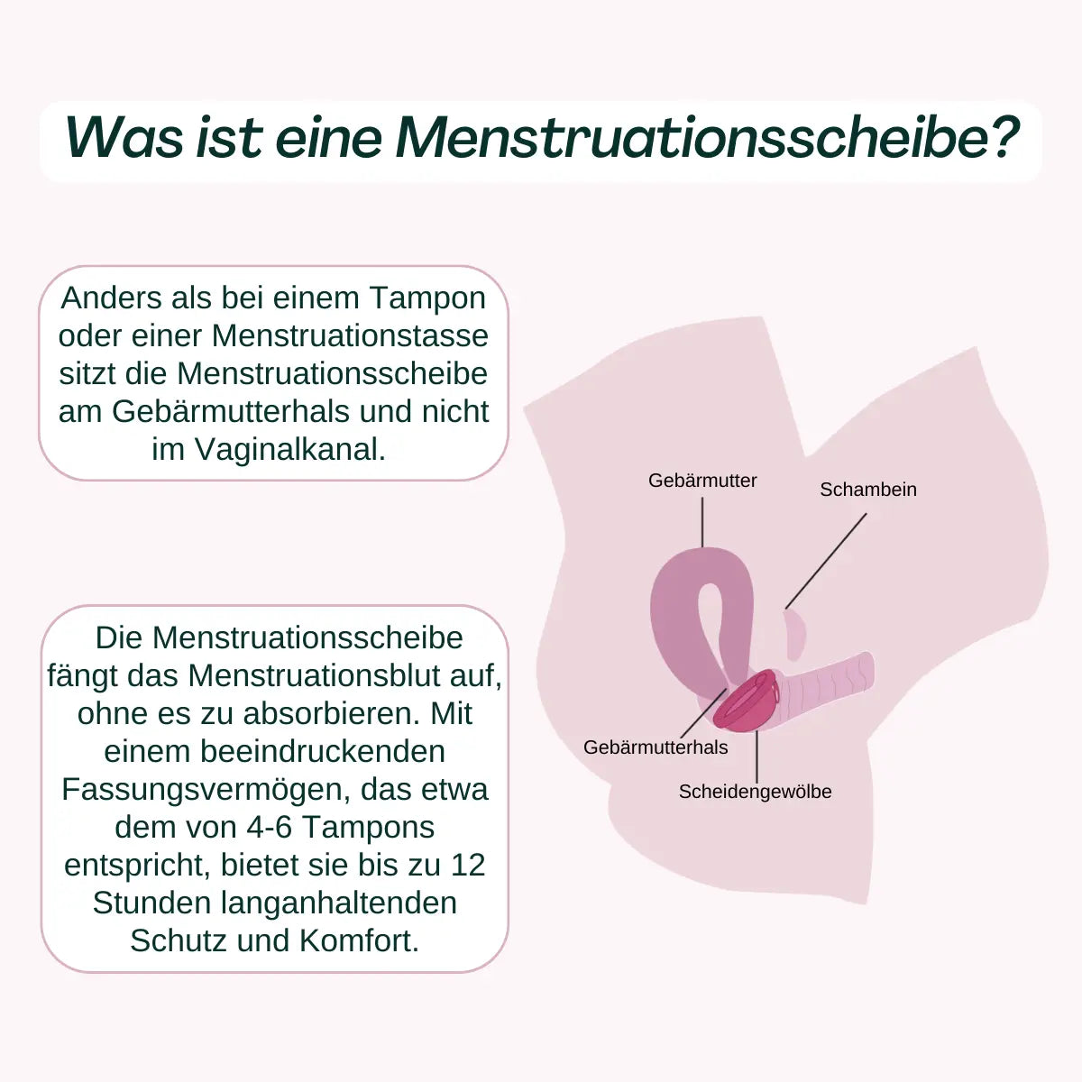 VenusDisc - Was ist eine Menstruationsscheibe?