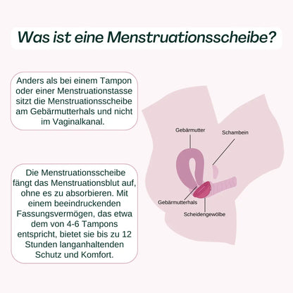 VenusDisc - Was ist eine Menstruationsscheibe?