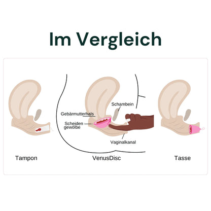 VenusDisc Beginner Set